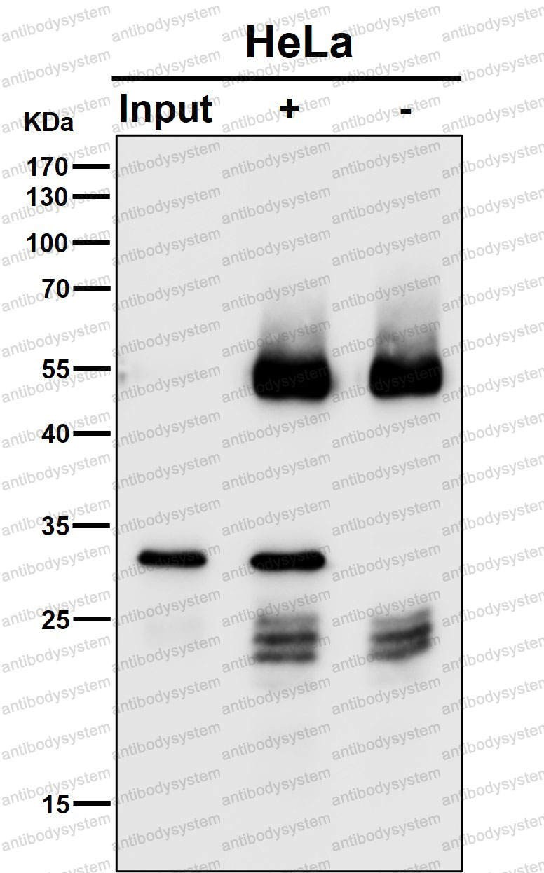 Anti-CHMP2B Antibody (R2M22)