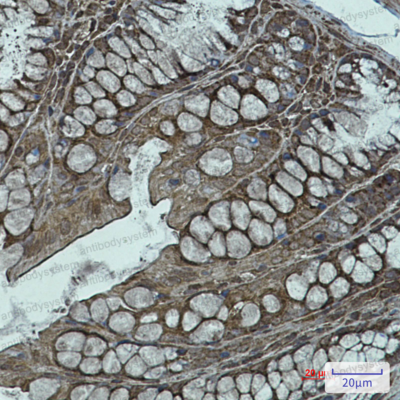 Anti-NDUFB11 Antibody (R2M23)