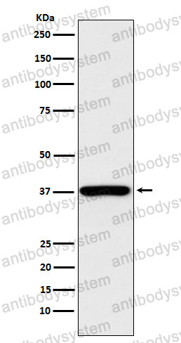 Anti-QKI Antibody (R2M24)