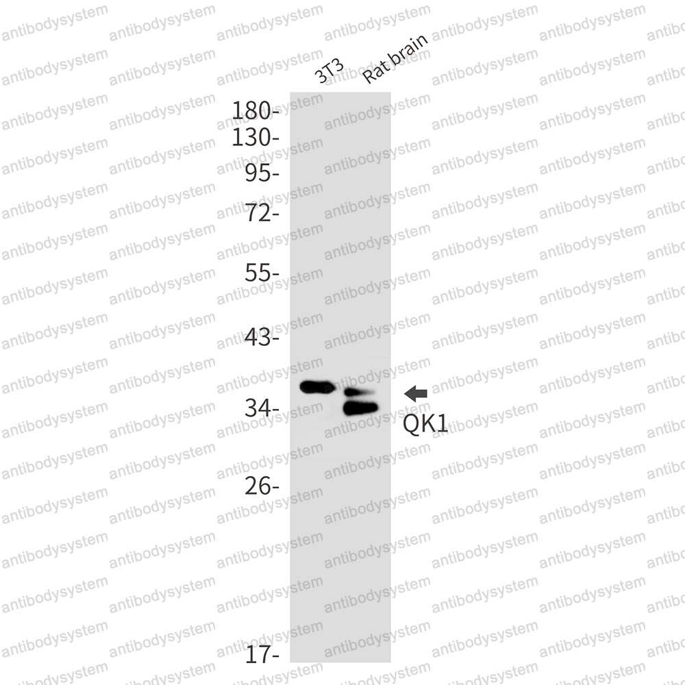 Anti-QKI Antibody (R2M25)