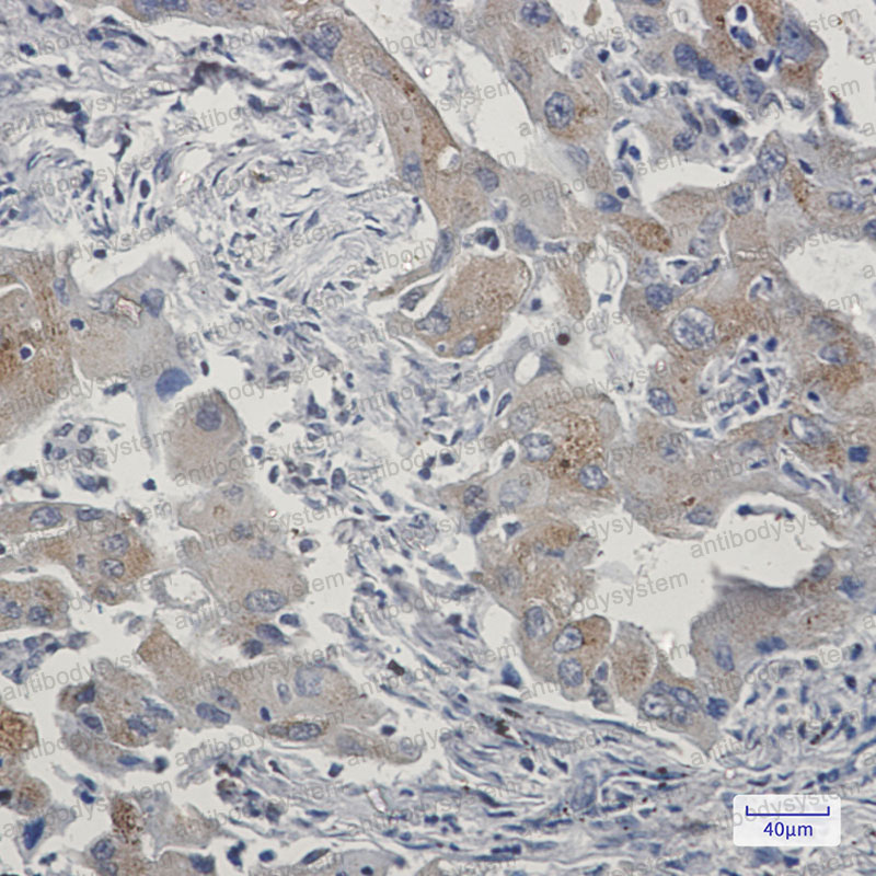 Anti-TAX1BP1 Antibody (R2M27)