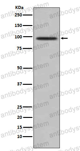 Anti-TAX1BP1 Antibody (R2M26)