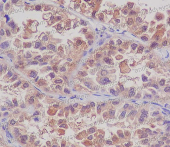 Anti-MSI2 Antibody (R2M29)
