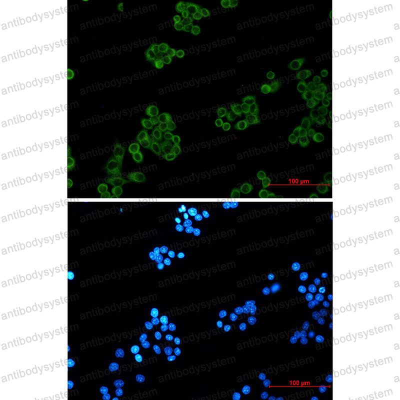 Anti-EHD1 Antibody (R2M31)