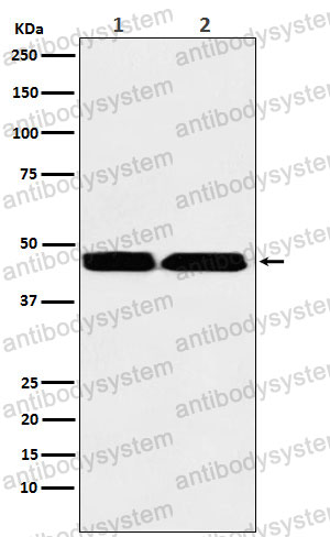 Anti-KMT1B/SUV39H2 Antibody (R2M32)