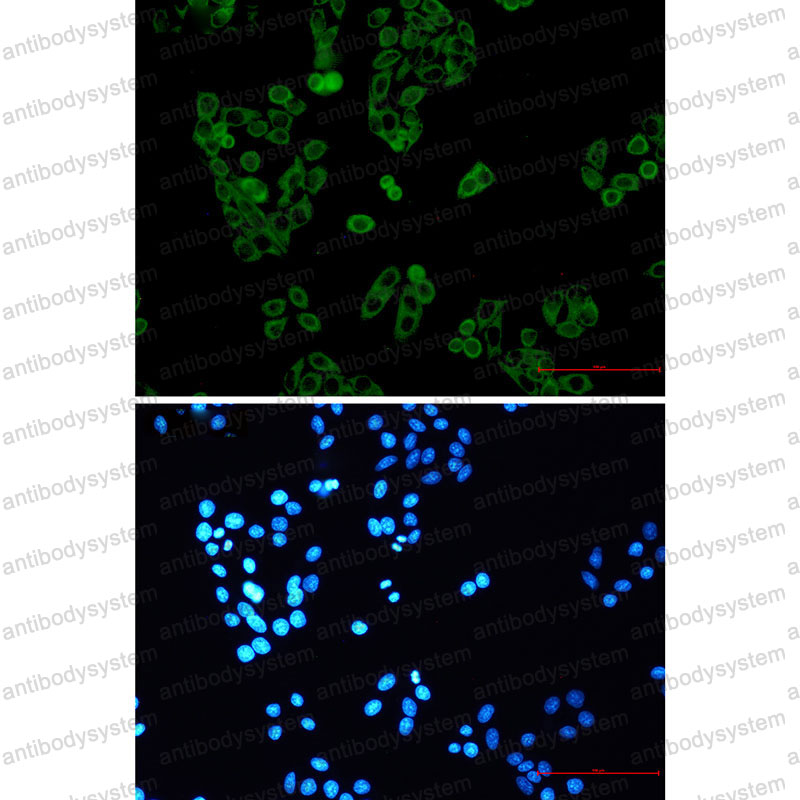 Anti-UPF1 Antibody (R2M34)