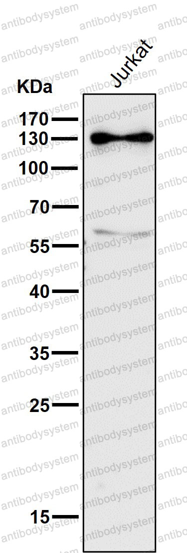 Anti-RENT1/hUPF1 Antibody (R2M33)