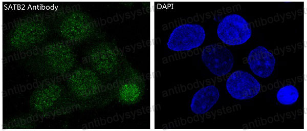 Anti-SATB2 Antibody (R1A49)