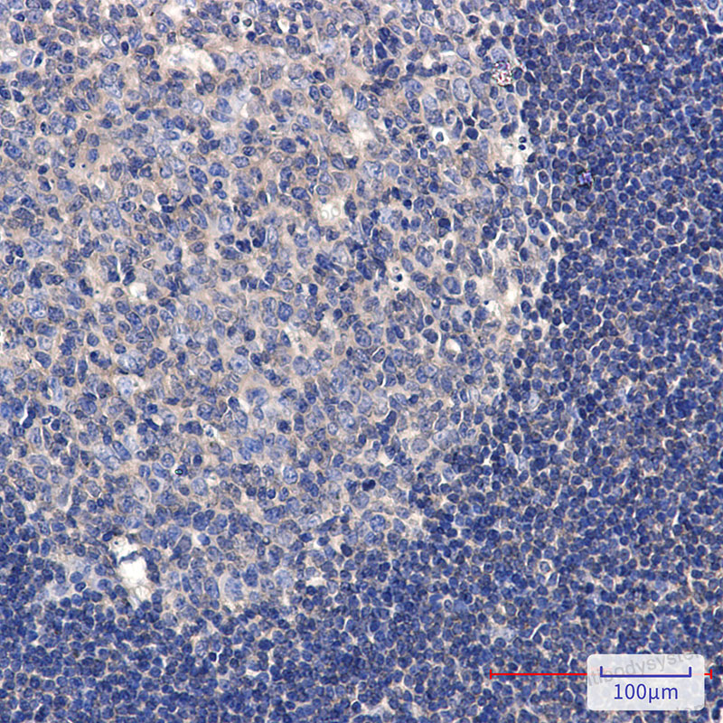 Anti-Phospho-TAOK1/2/3 (Ser181/Ser181/Ser177) Antibody (R2M46)