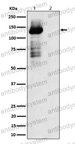 Anti-Phospho-TAOK1/2/3 (S181 + S181 + S177) Antibody (R2M45)