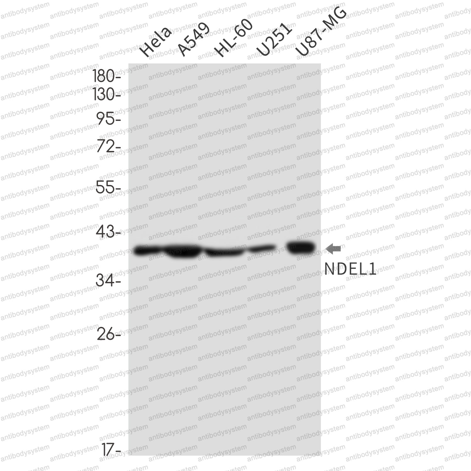 Anti-NDEL1 Antibody (R2M49)