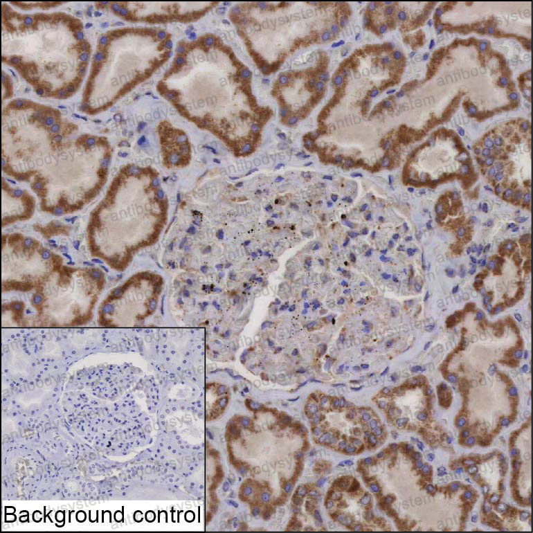 Immunohistochemical for Anti-ACAD9 Antibody (R3Z14) ?>