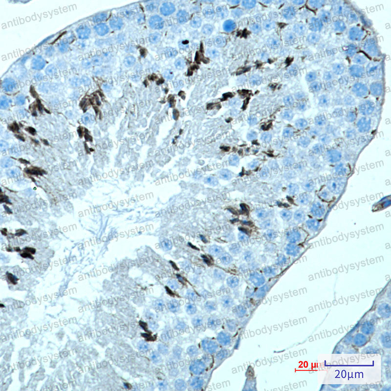 Anti-MAGEC2 Antibody (R2M65)