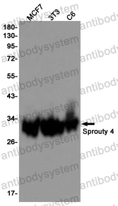 Anti-SPRY4 Antibody (R2M69)