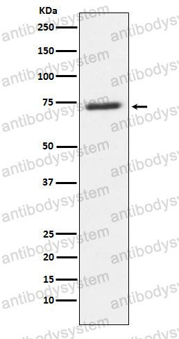 Anti-SENP1 Antibody (R2M71)