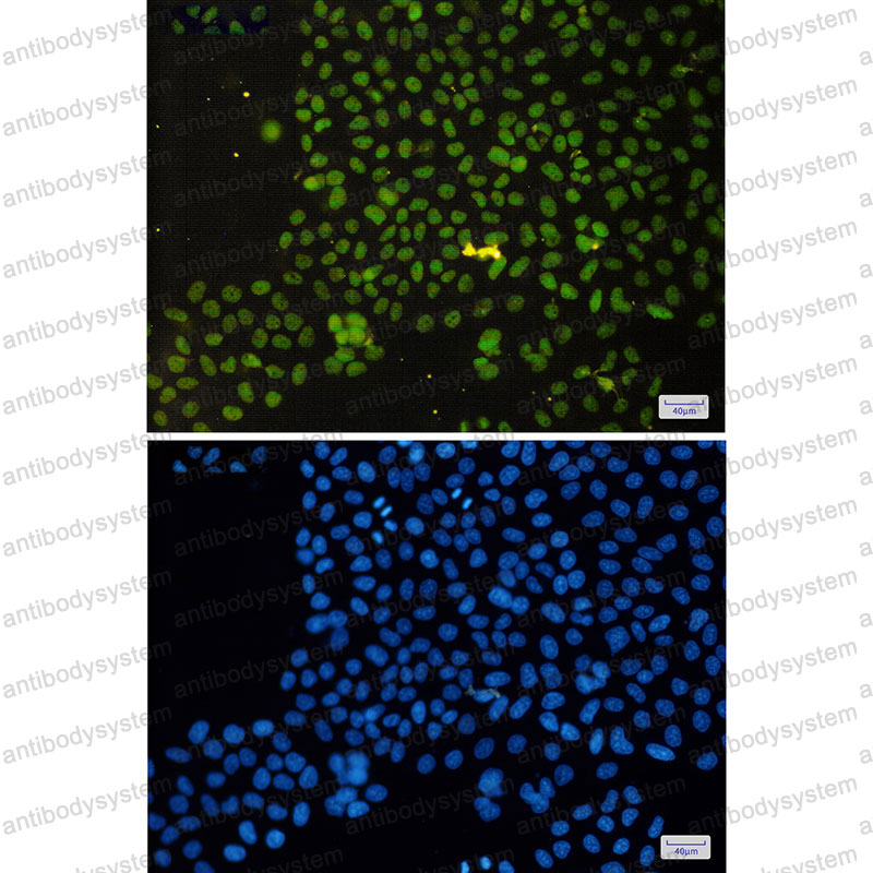 Anti-ASH2L Antibody (R2M73)