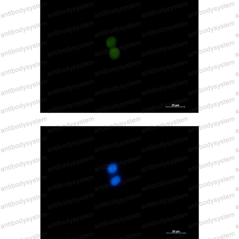 Anti-ASH2L Antibody (R2M72)