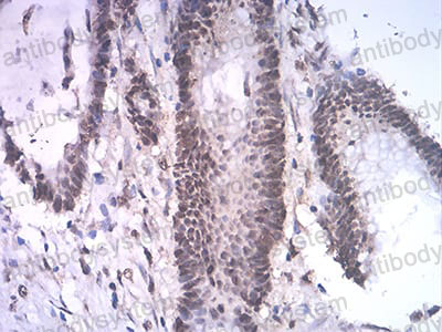 Immunohistochemical for Anti-ASH2L Antibody (R3Z24) ?>