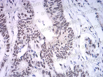 Immunohistochemical for Anti-ASH2L Antibody (R3Z24) ?>