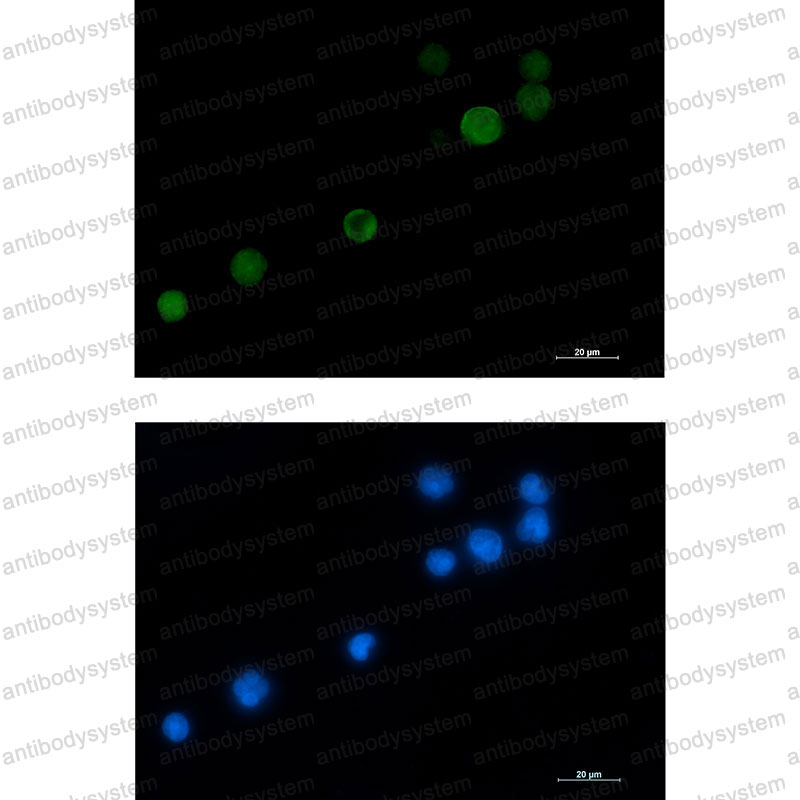 Anti-KIF2C Antibody (R2M75)