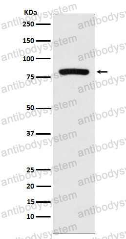 Anti-KIF2C Antibody (R2M74)