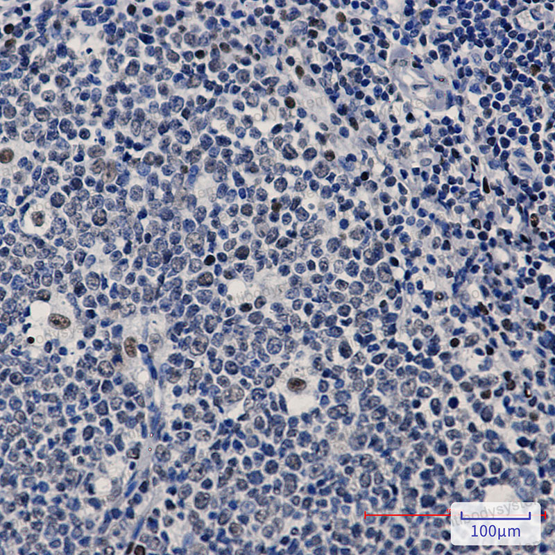 Anti-PREB Antibody (R2M77)