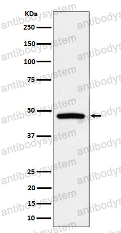 Anti-PREB Antibody (R2M76)