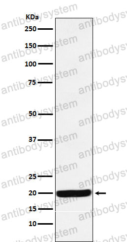 Anti-RBM8A Antibody (R2M78)