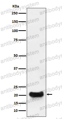 Anti-DCTN5 Antibody (R2M79)