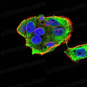 Immunofluorescence for Anti-DDX20 Antibody (R3Z28) ?>