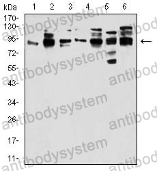 Western blot for Anti-DDX20 Antibody (R3Z28) ?>