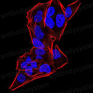 Immunofluorescence for Anti-DDX20 Antibody (R3Z27) ?>