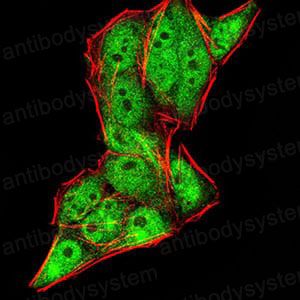 Immunofluorescence for Anti-DDX20 Antibody (R3Z27) ?>