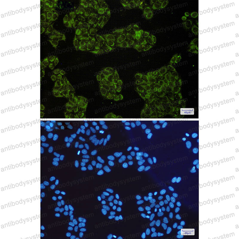 Anti-DIABLO Antibody (R2M81)