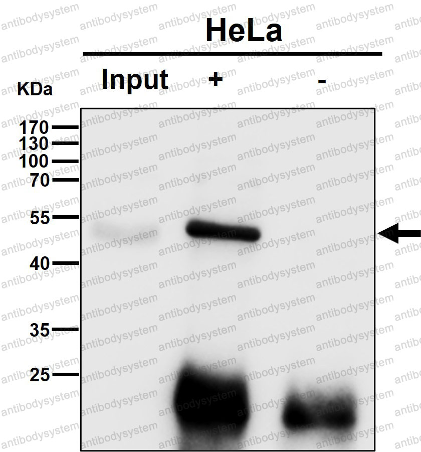 Anti-PICK1 Antibody (R2M82)
