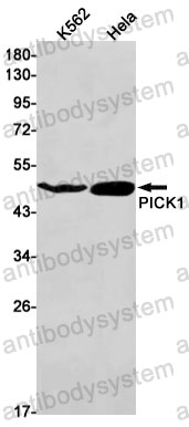 Anti-PICK1 Antibody (R2M83)