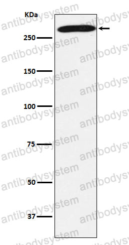 Anti-PRPF8 Antibody (R2M84)
