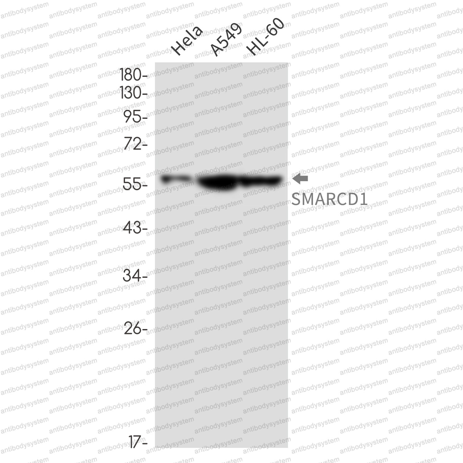 Anti-SMARCD1 Antibody (R2M85)