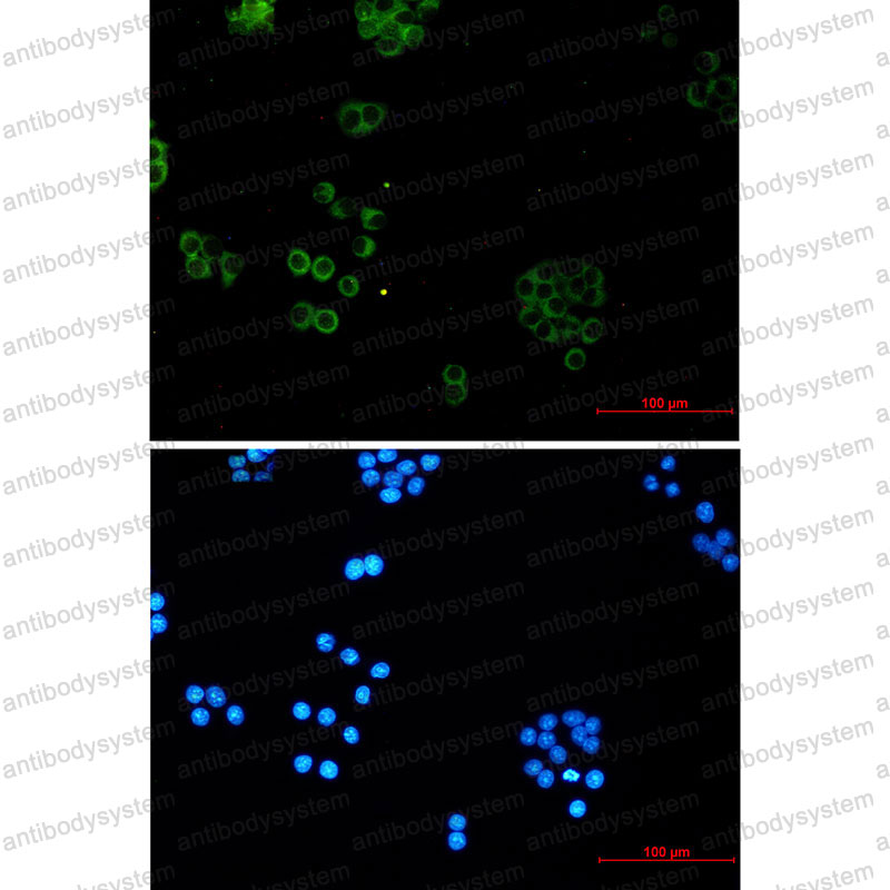 Anti-SNX5 Antibody (R2M87)