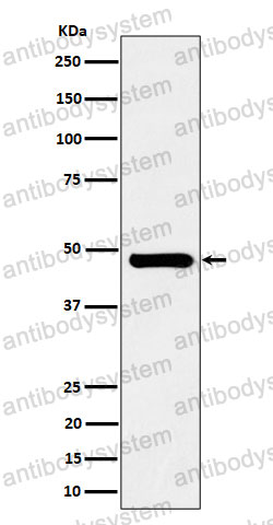 Anti-SNX5 Antibody (R2M86)