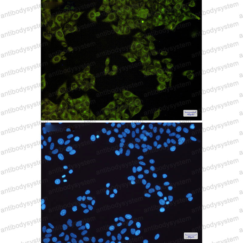 Anti-STK26 Antibody (R2M89)