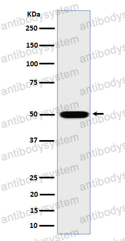 Anti-STK26 Antibody (R2M88)