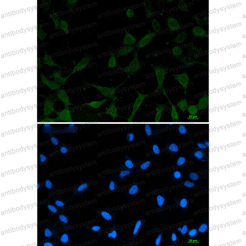 Anti-Phospho-NDRG1 (Ser330) Antibody (R2M91)
