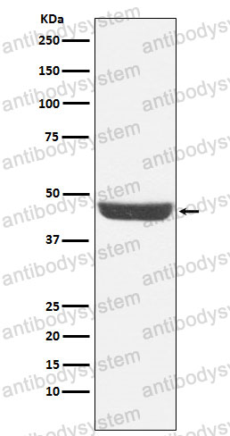 Anti-NDRG1 Antibody (R2M90)