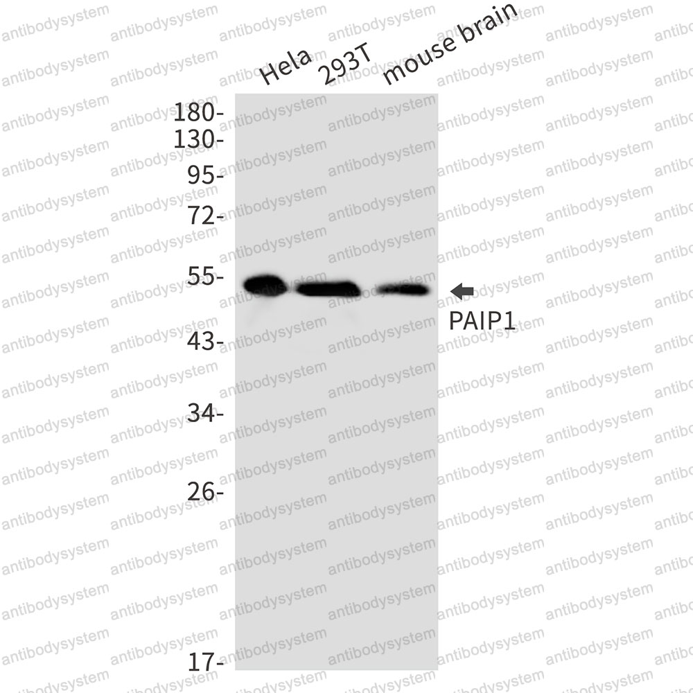 Anti-PAIP1 Antibody (R2M93)