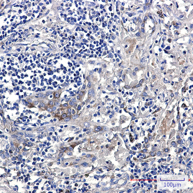 Anti-ERAP1 Antibody (R2M95)