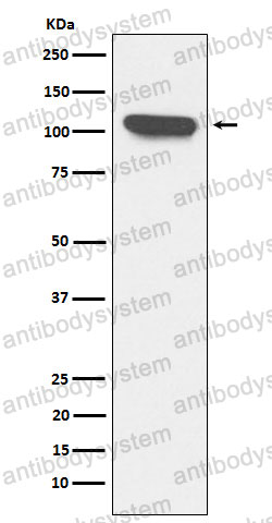 Anti-ERAP1 Antibody (R2M94)