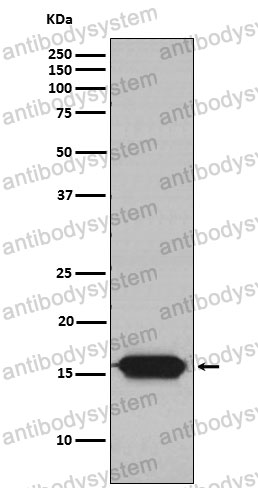 Anti-NDUFA13 Antibody (R2M96)