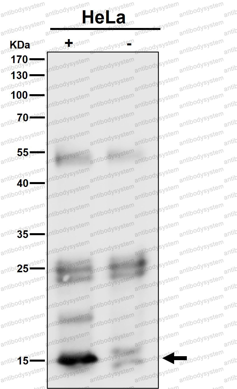 Anti-VAMP8 Antibody (R2M98)