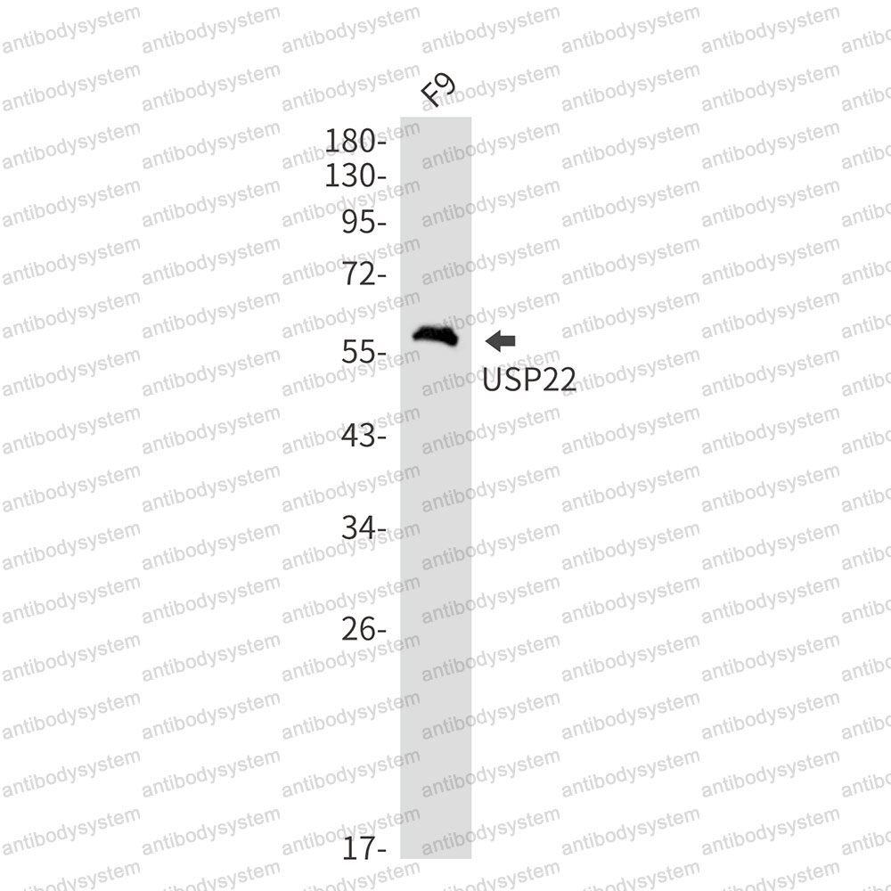 Anti-USP22 Antibody (R2N02)
